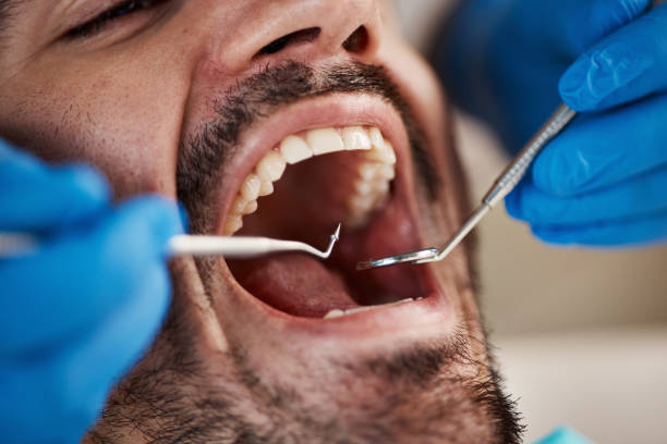 Best Weekend Emergency Dentist in West Jefferson, OH